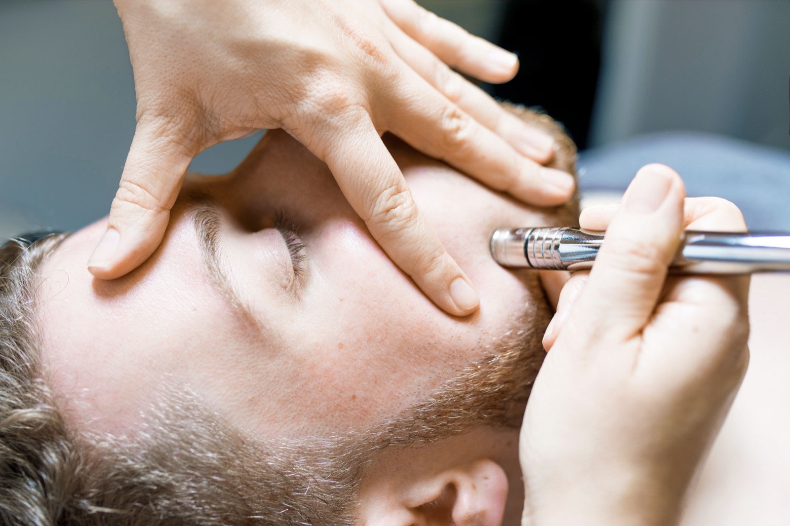 Mikrodermabrasion