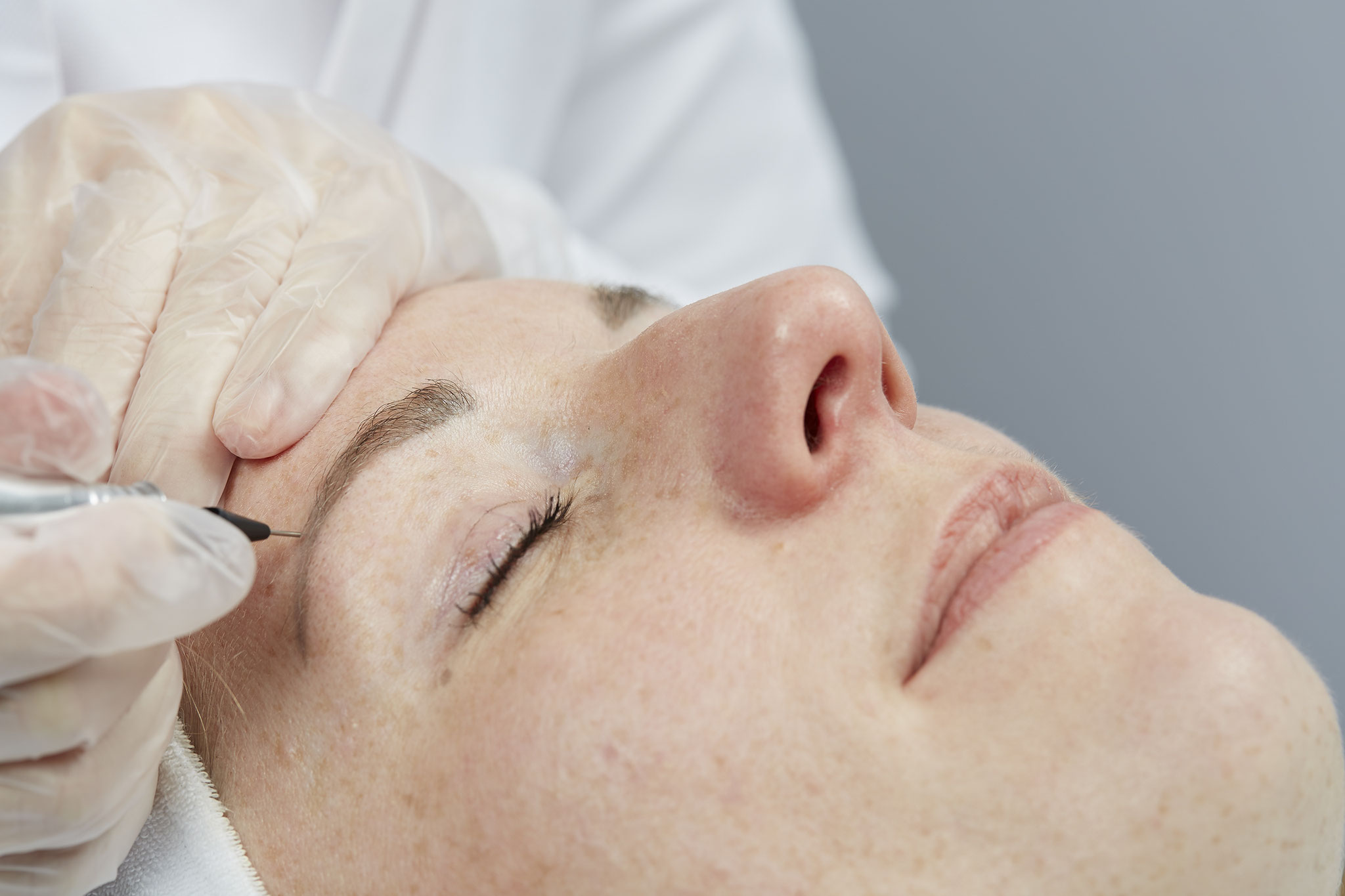 Natürlich aufgefrischte und korrigierte Augenbrauen nach Permanent Make-up bei Lisa Grabinger
